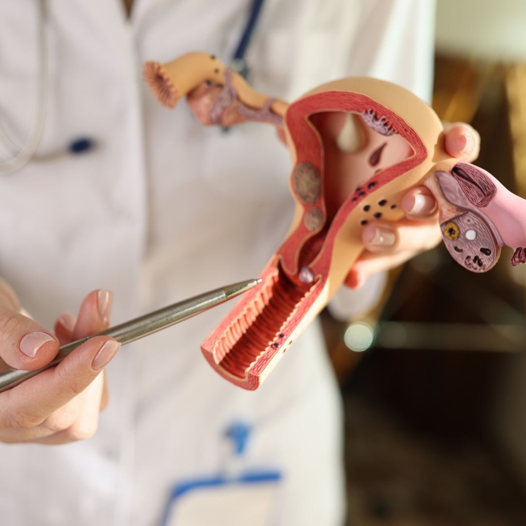 doctor with medical model of uterus